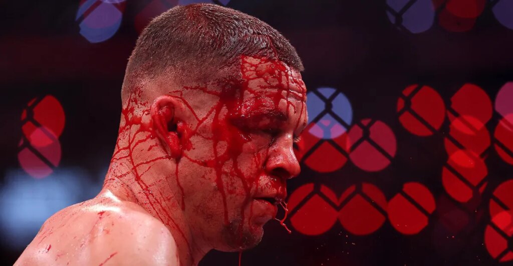 Nate Diaz releases first statement after losing to Mike Perry on Rousey vs. Carano card: ‘Time to kill now’