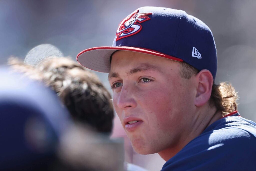 Rockies prospect Ethan Holliday set for foot surgery, will miss rest of season: Source Rockies prospect Ethan Holliday set for foot surgery, will miss rest of season: Source