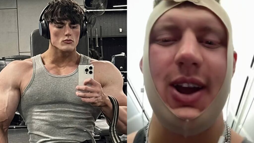 ‘Looksmaxxing’ streamer Androgenic kicked off plane after facial surgery makes him “very ill” A photo of QTCinderella holding a teacup.