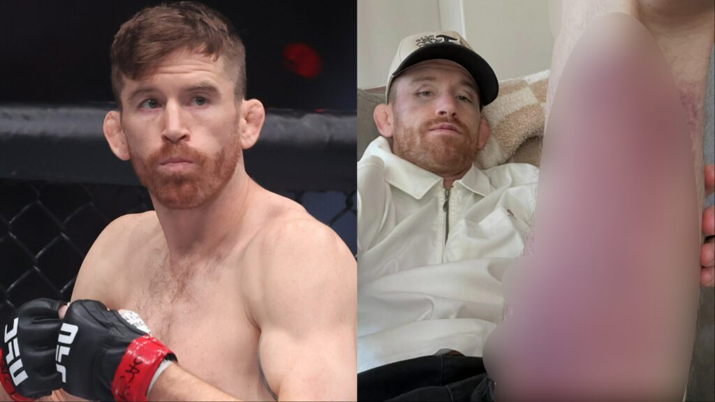 Cory Sandhagen before and after his UFC 329 fight