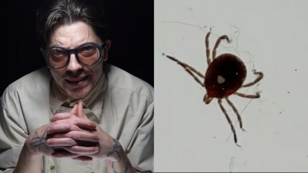 YouTuber Rusty Cage spends days trying to kill tick found in body by freezing & drowning it RustyCage trying to kill tick