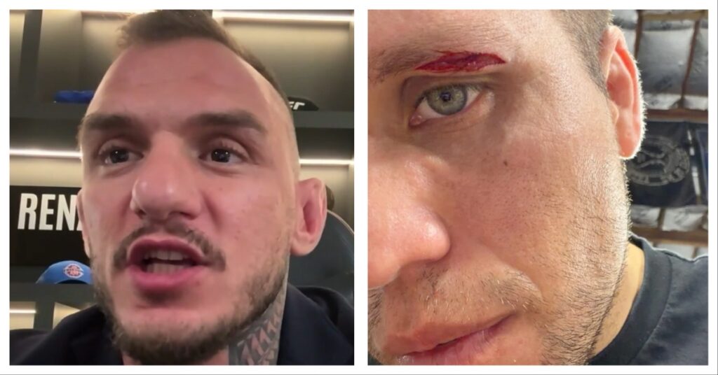 Renato Moicano Claims Brian Ortega Is ‘Not In A Good Place Mentally’ Following UFC 331 Pullout Renato Moicano UFC 331 Brian Ortega